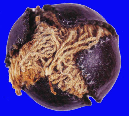 19th Century Lemon Peel Ball 11